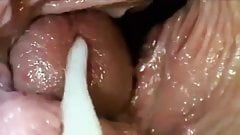 Beetle reccomend video inside vagina