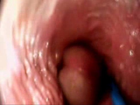 View inside vagina