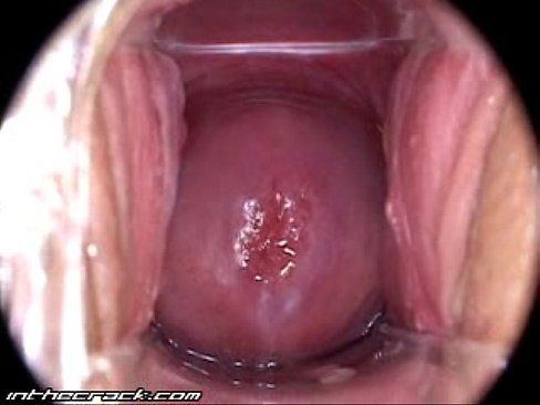 Budweiser reccomend Views inside a womans vagina when she has an orgasm