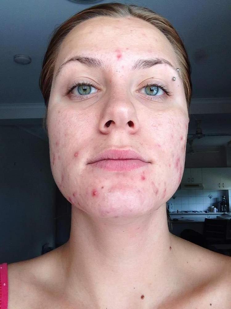 Pics of facial scaly skin