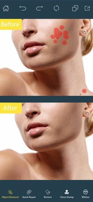 Removing facial age spots