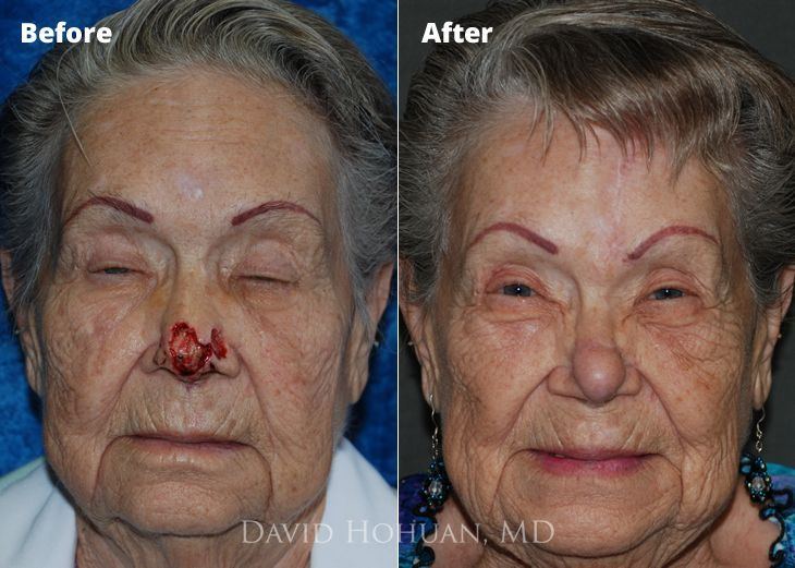 Woodshop reccomend Facial reconstructive and cosmetic surgery