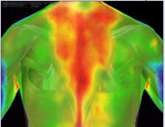 X-Ray reccomend Computerized breast thermal imaging
