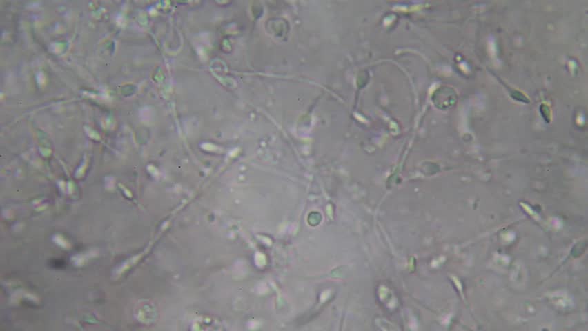 Human sperm microscope