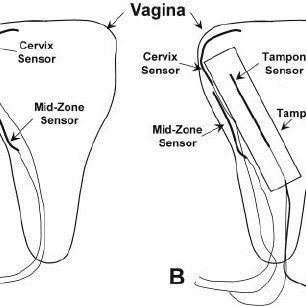 Subwoofer recommendet vagina Multiple insertion