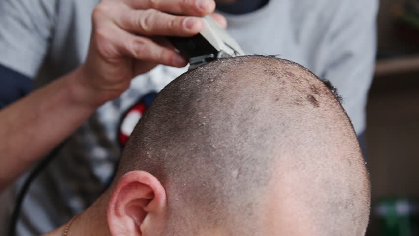 Superwoman reccomend shaved head Lice