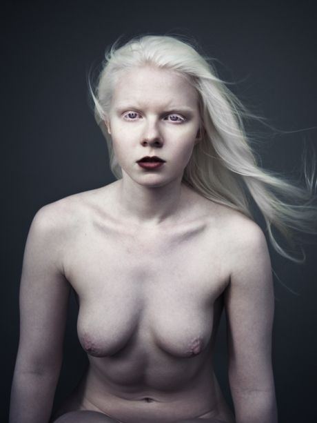 Home P. reccomend Naked pictures of albino girls