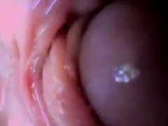 Bloomer reccomend Cam inside anus