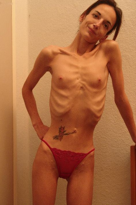 Lexus reccomend Photos anorexis gils nude