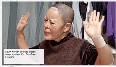 Kim facial plastic surgery complaints