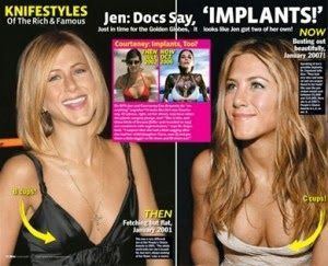 Aniston boob did get jennifer job
