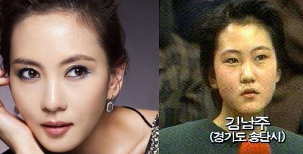 Asian celebrities with plastic surgery