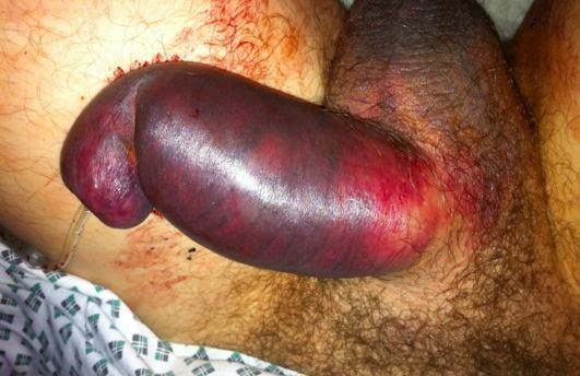 best of And bleeding sex Rough