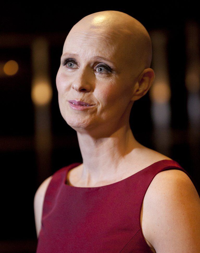 Picture of shaved bald head of women