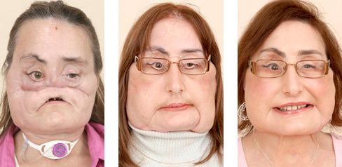 best of Reconstructive and cosmetic surgery Facial