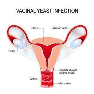 My vagina feels inlamed