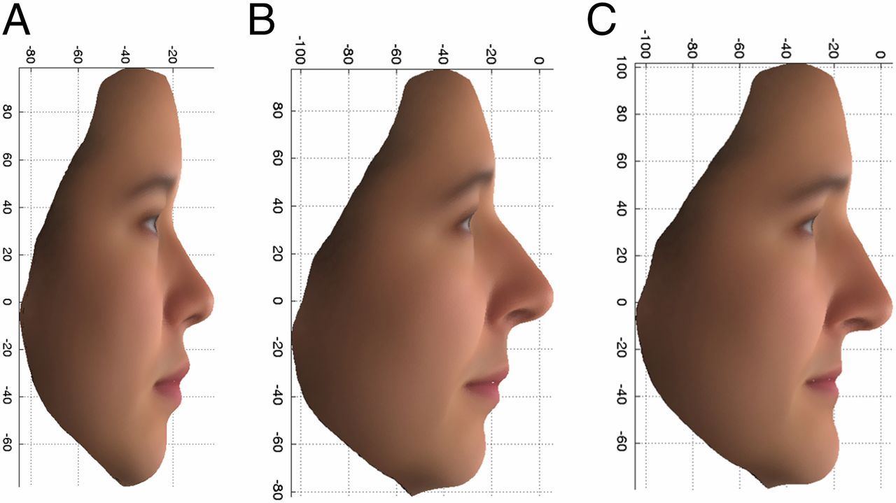 best of Analysis profile Facial facial