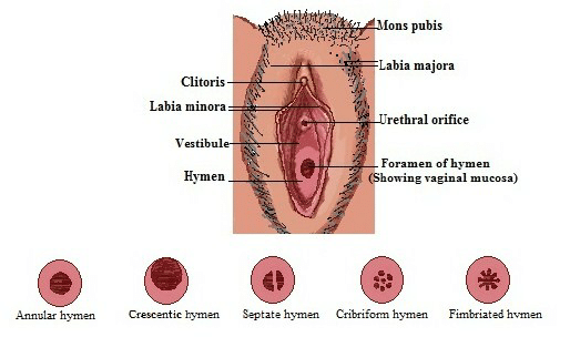 Abnormal vagina anatomy pics