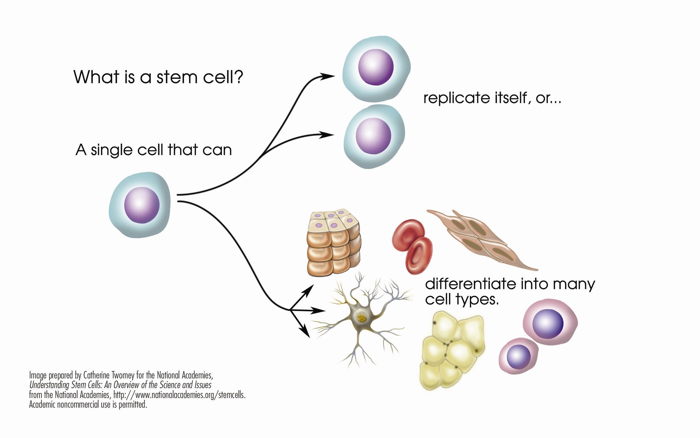 Adult stem cell multiple sclerosis