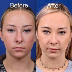 best of Procedures and cosmetic md Facial