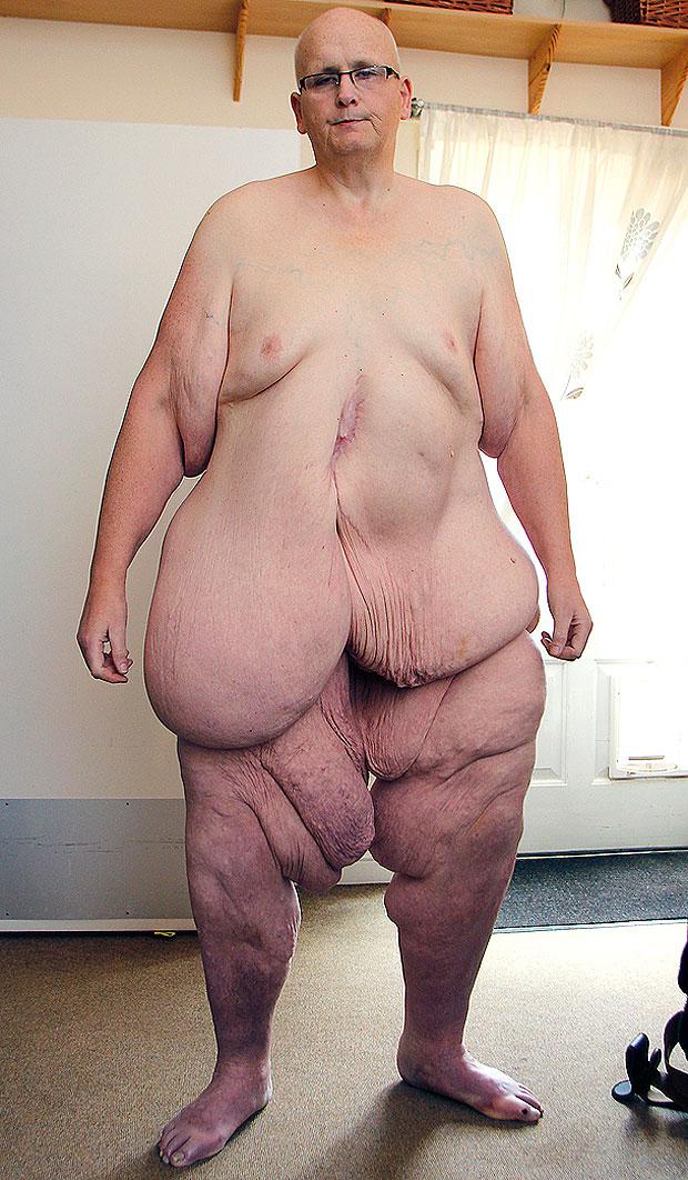 World Fattest Woman Vagina Nude Pics