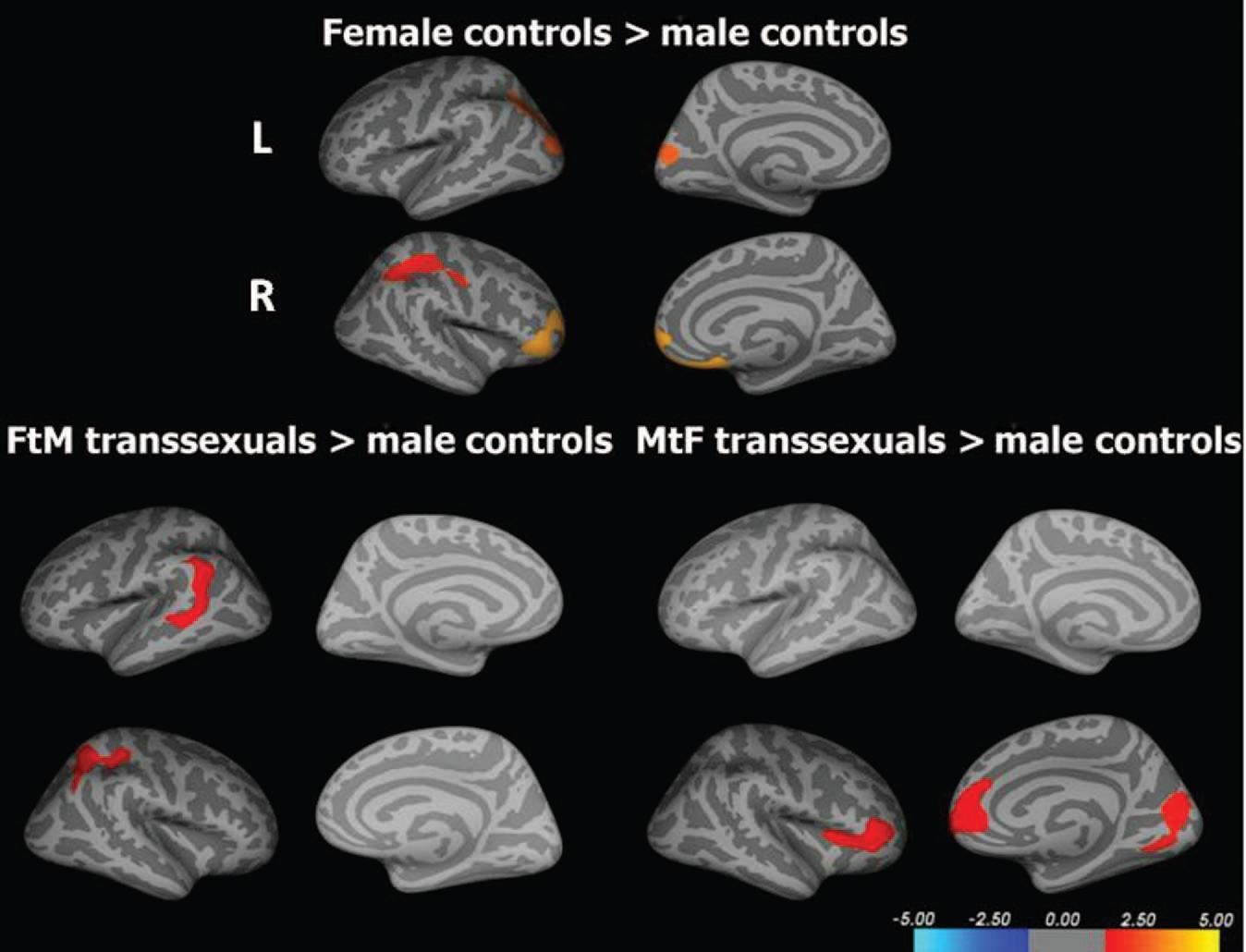 best of Brain study Gay