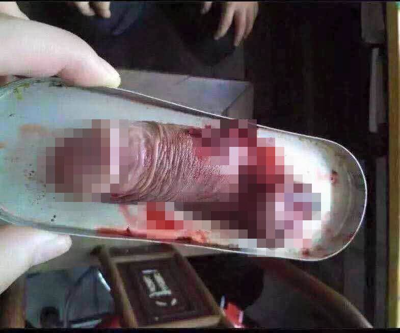 Wife cut off his penis