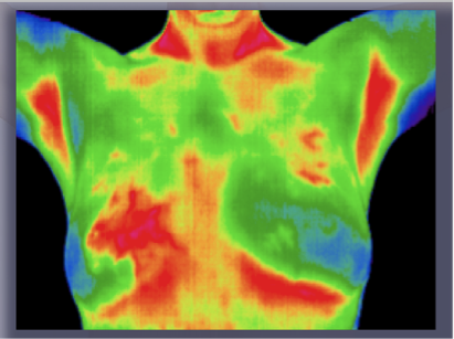 best of Breast thermal imaging Computerized