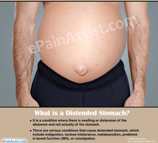 best of Bloating anal pain with Abdominal in and pressure along