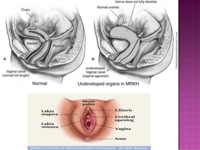 The P. reccomend Abnormal vagina anatomy pics