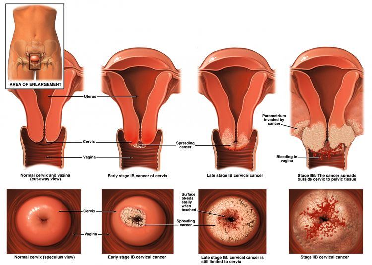 Midnight recommendet Abnormal vagina anatomy pics