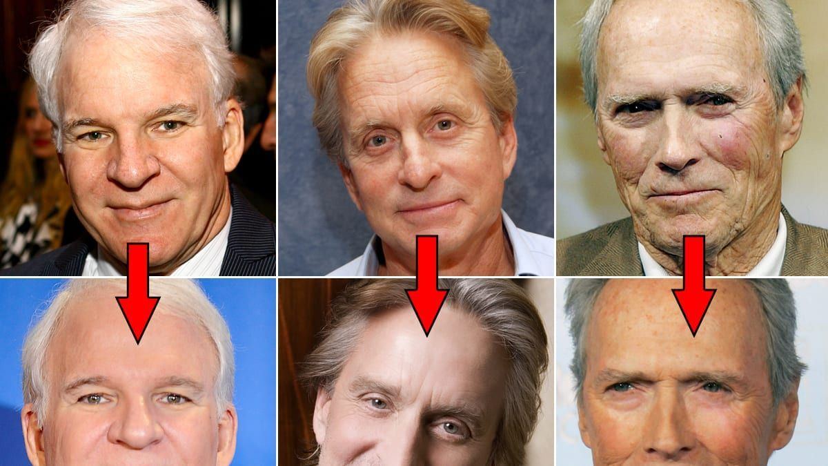 Actors without facial surgeries