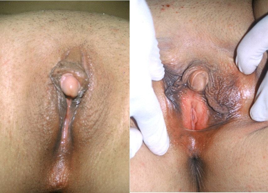 best of Clitoris Aroused erect