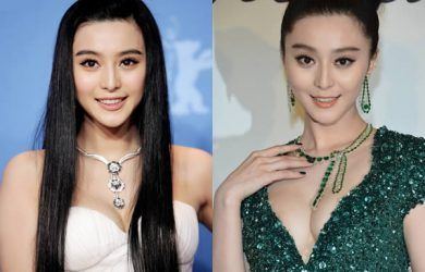 best of Plastic with Asian surgery celebrities
