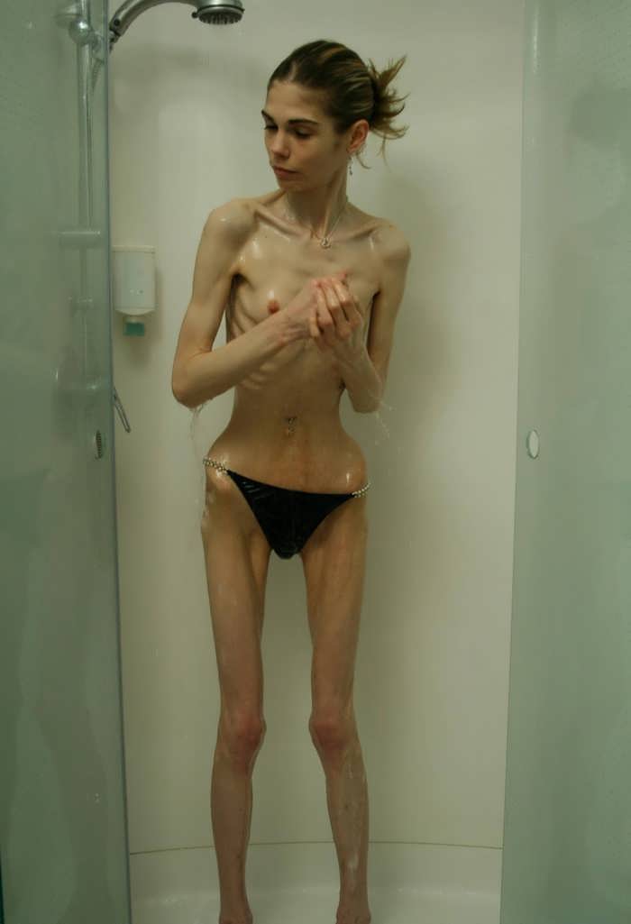 Anorexic Asian Nude