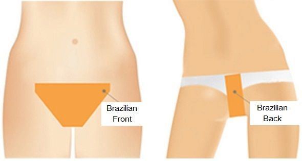 Brazilian bikini hair removal pictures