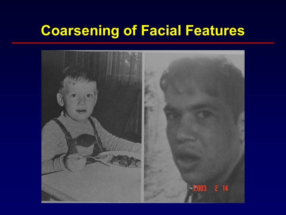 Coarsening of facial