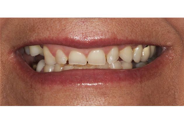 Cosmetic Dentistry Facial Profile Hot Nude Comments