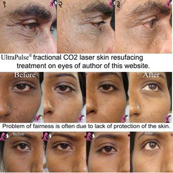 Quasar reccomend Severe facial skin care
