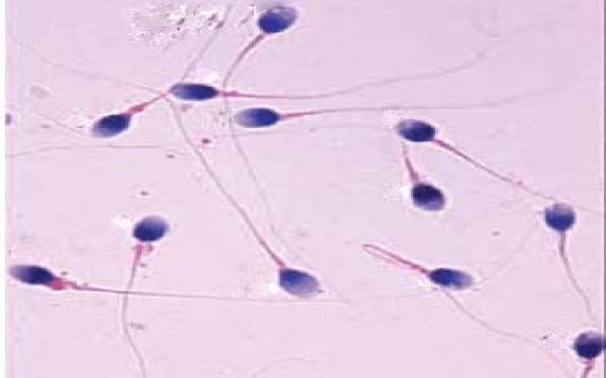 Bloomer reccomend Human picture sperm