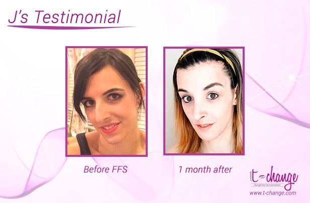 Facial feminization cream
