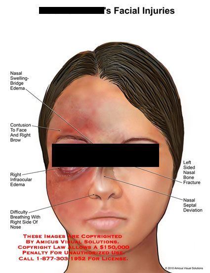 Cosmos recommendet solutions Facial edema