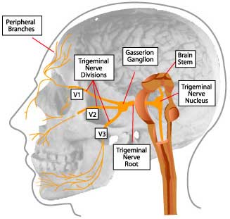 best of Nerve damage peripheral dental Facial