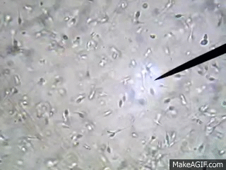 best of Sperm microscope Human