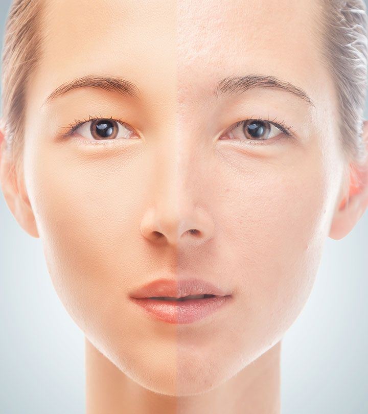 Skin condition oily scaly facial skin