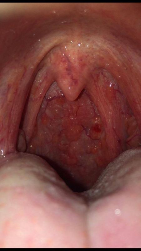 Black W. reccomend Sore vagina sore skin sore throat