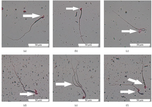 best of Mice abnormalities Sperm shape
