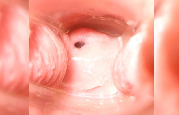 Sperm shooting inside a vagina