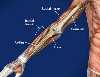 Splint for thumb radial nerve surgery