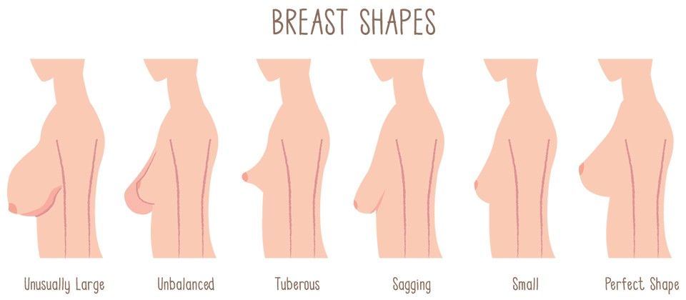 Surgery of the breast